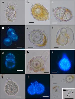 Evolutionary Trends of Perkinsozoa (Alveolata) Characters Based on Observations of Two New Genera of Parasitoids of dinoflagellates, Dinovorax gen. nov. and Snorkelia gen. nov.